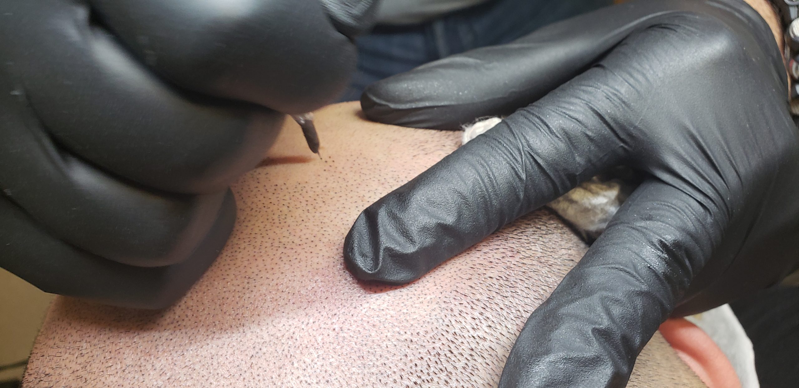 A Rico Clinic practitioner performing a treatment in Montreal
