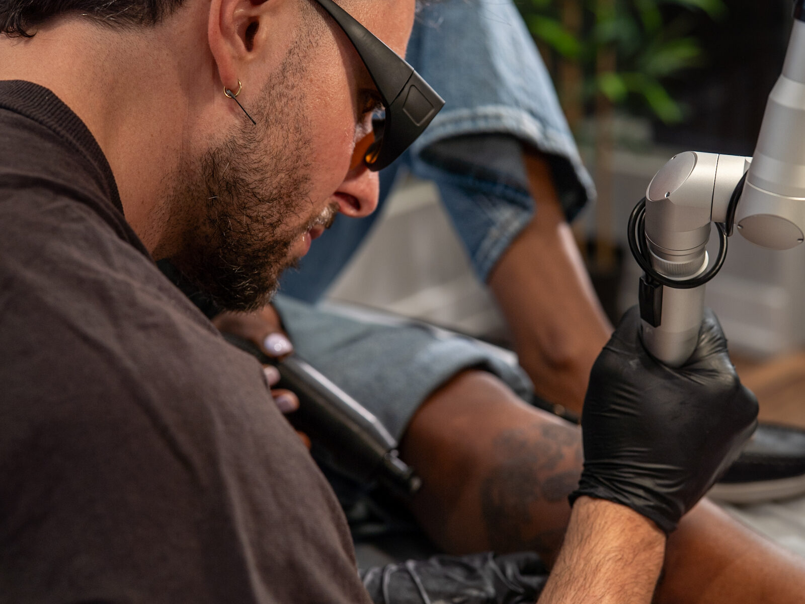 Vlad treating a leg tattoo with the removal laser at Rico Clinic