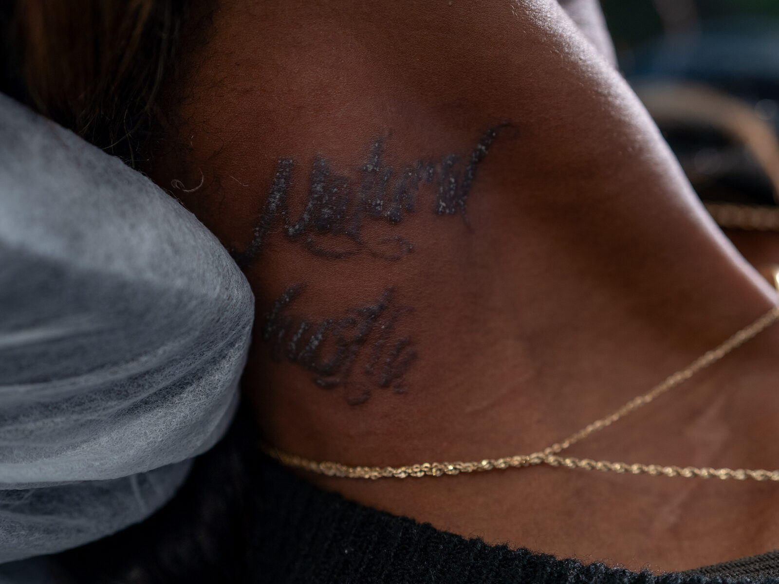 A neck tattoo before laser removal treatment at Rico Clinic