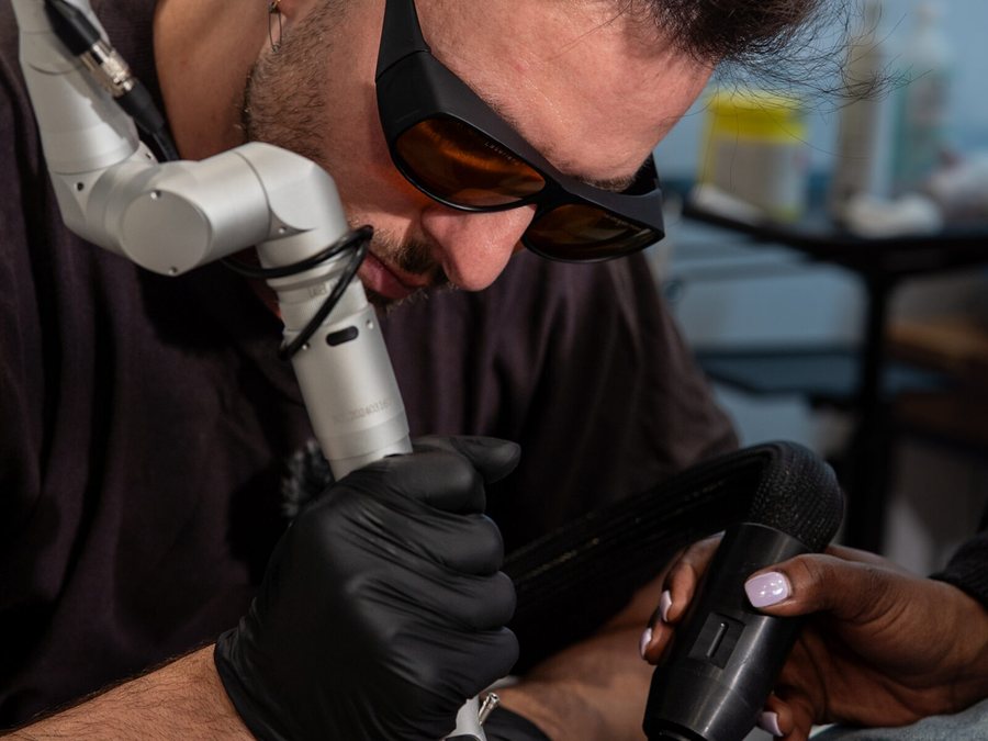 Laser tattoo removal session at Rico Clinic, Montreal