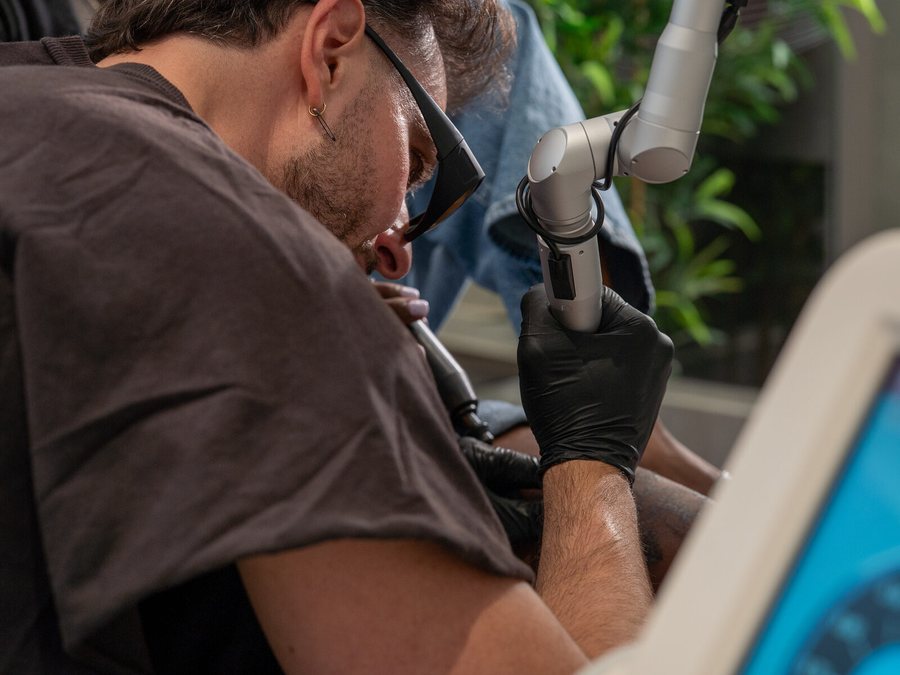 Laser tattoo removal session at Rico Clinic, Montreal