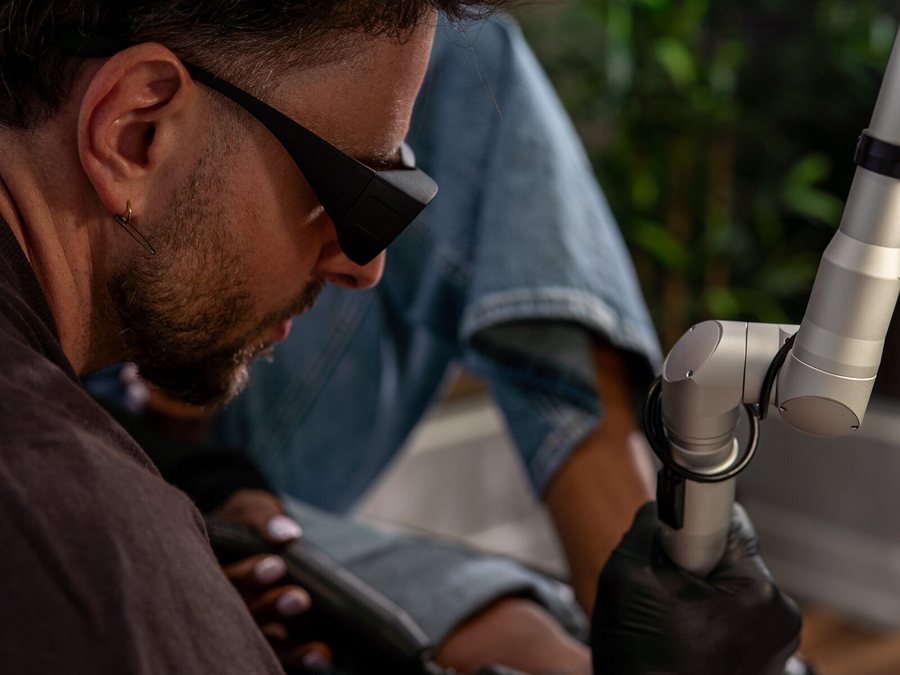 Laser tattoo removal session at Rico Clinic, Montreal