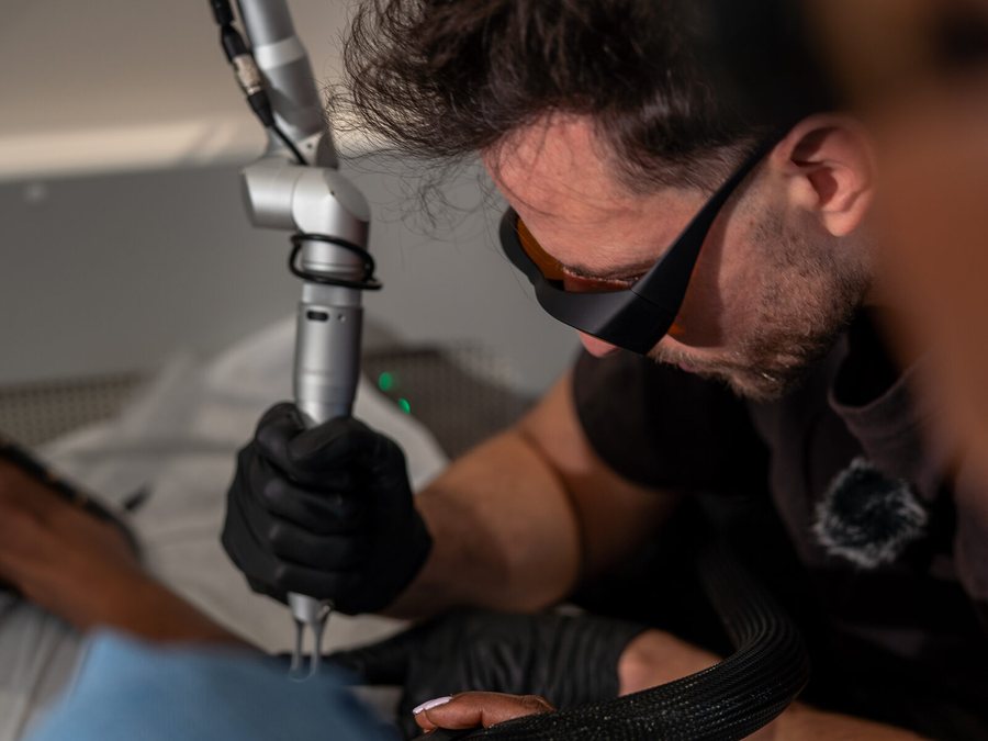 Laser tattoo removal session at Rico Clinic, Montreal
